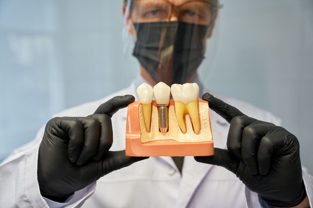 Dentist holding a tooth model explaining root canal treatment in Lemont, IL.